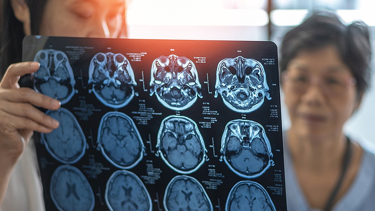 Older female looking at a brain scan image