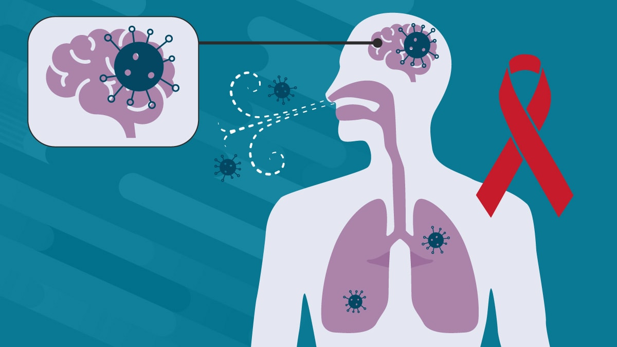 Illustration of a sillouhette of a person breathing in spores depicted as dots and Cryptococcus.. The brain is highlighted showing cryptoccus in the brain from the lungs, An HIV ribbon is in the background