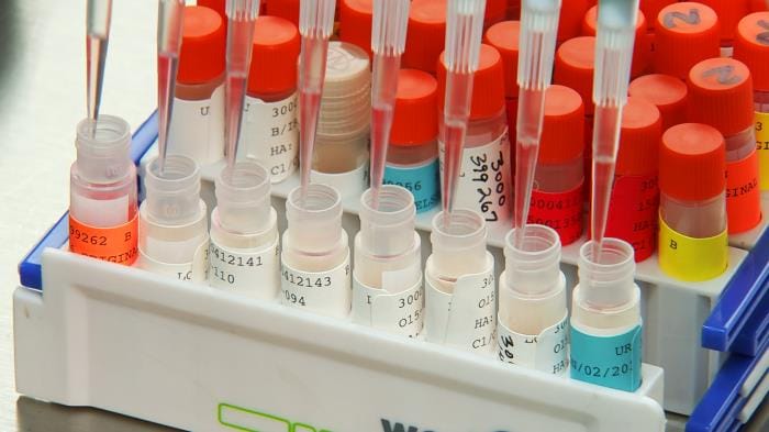 Lines of vials being filled by pipettes.