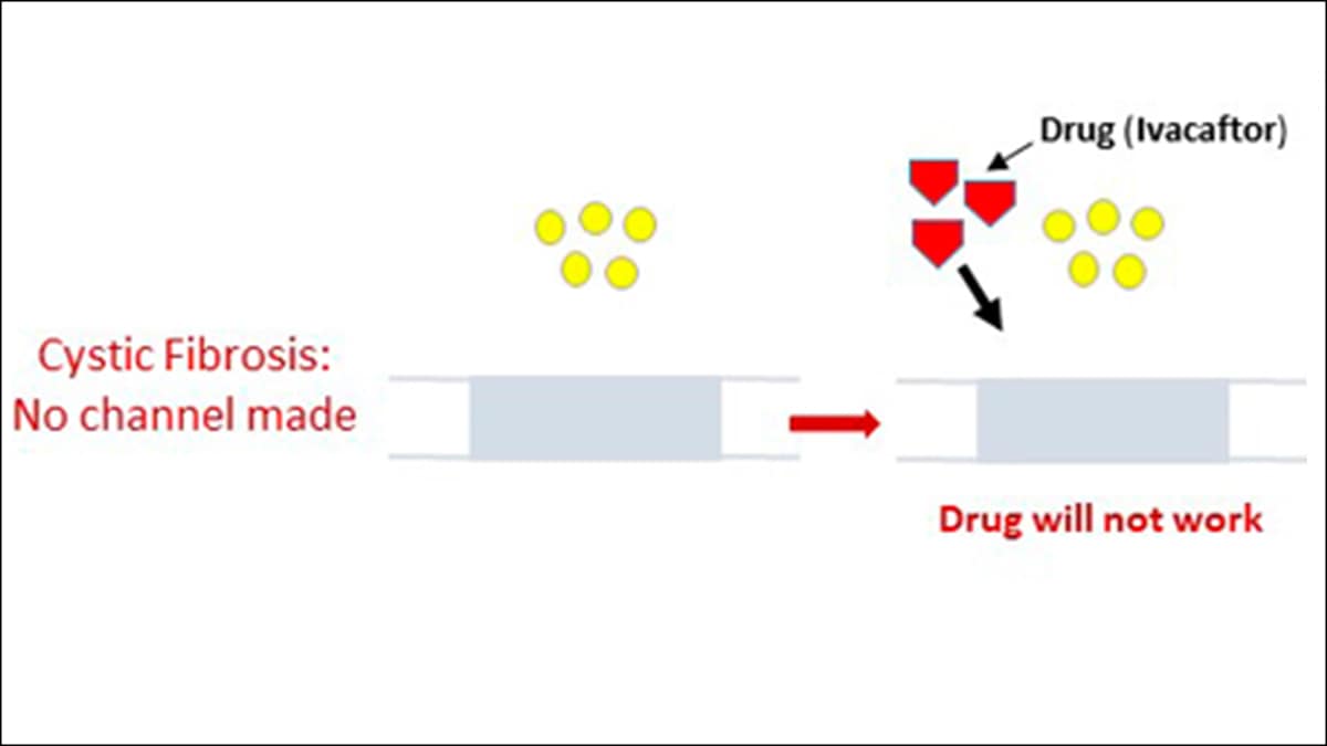 In some cases of cystic fibrosis, the channel is not made. The drug ivacaftor will not work.