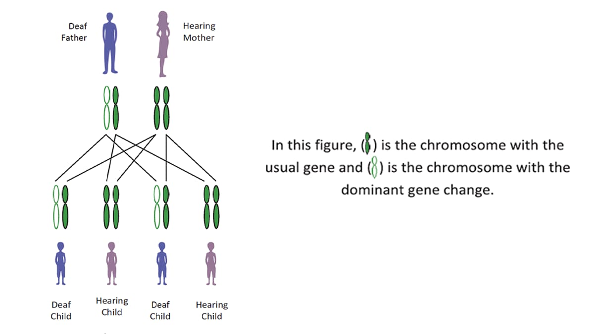 Figure of the chromosomes passed down from a hearing mother and deaf father to their children.