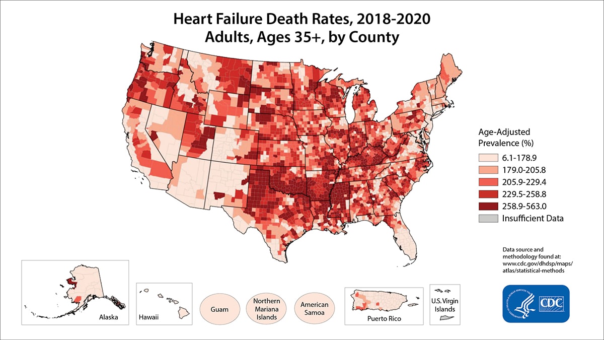 Heart Failure Death Rates for 2018 through 2020 for Adults Aged 35 Years and Older by County. The map shows that concentrations of counties with the highest heart disease death rates - meaning the top quintile - are located primarily in Mississippi, Louisiana, Arkansas, Oklahoma, Texas, Kentucky, Tennessee, Indiana, Illinois, and Wisconsin. Pockets of high-rate counties also were found in Oregon, Utah, Montana, South Dakota, and Nebraska.