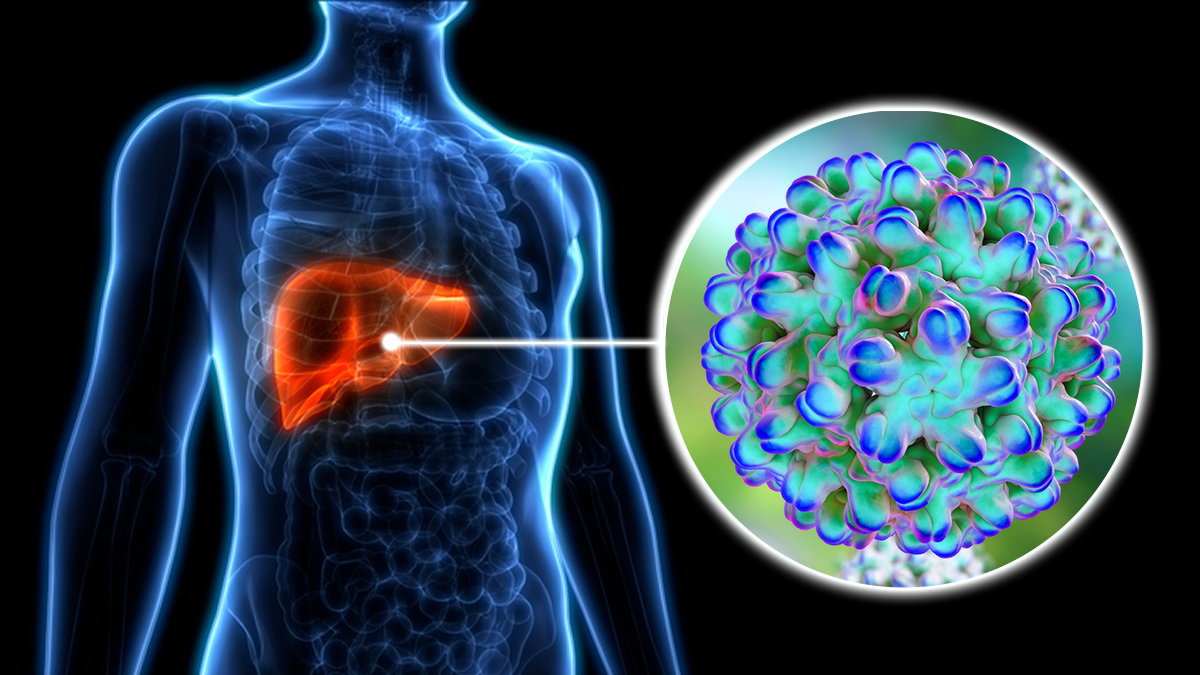 Artist rendition of the hepatitis D virus impact on the body