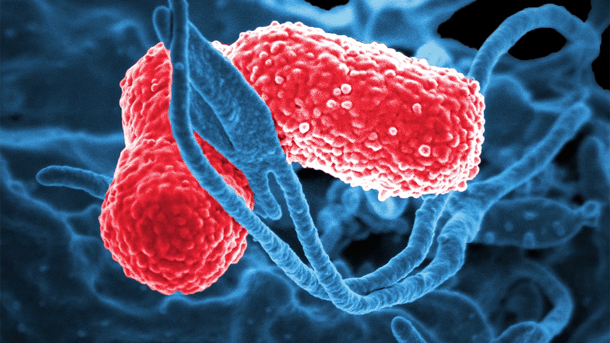 Medical illustration of Klebsiella