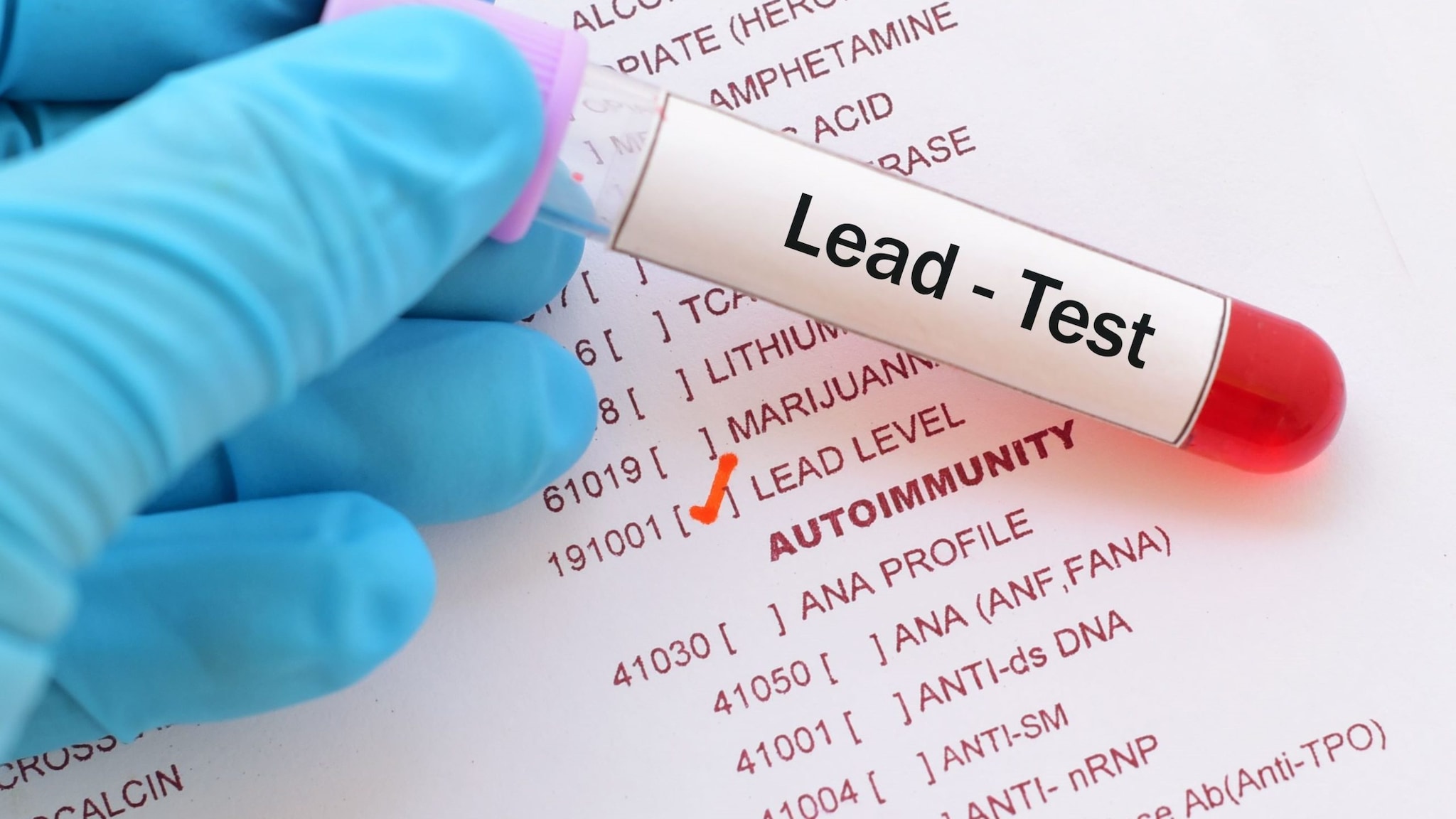 A hand with blue surgical glove holding a test tube marked Lead Test.