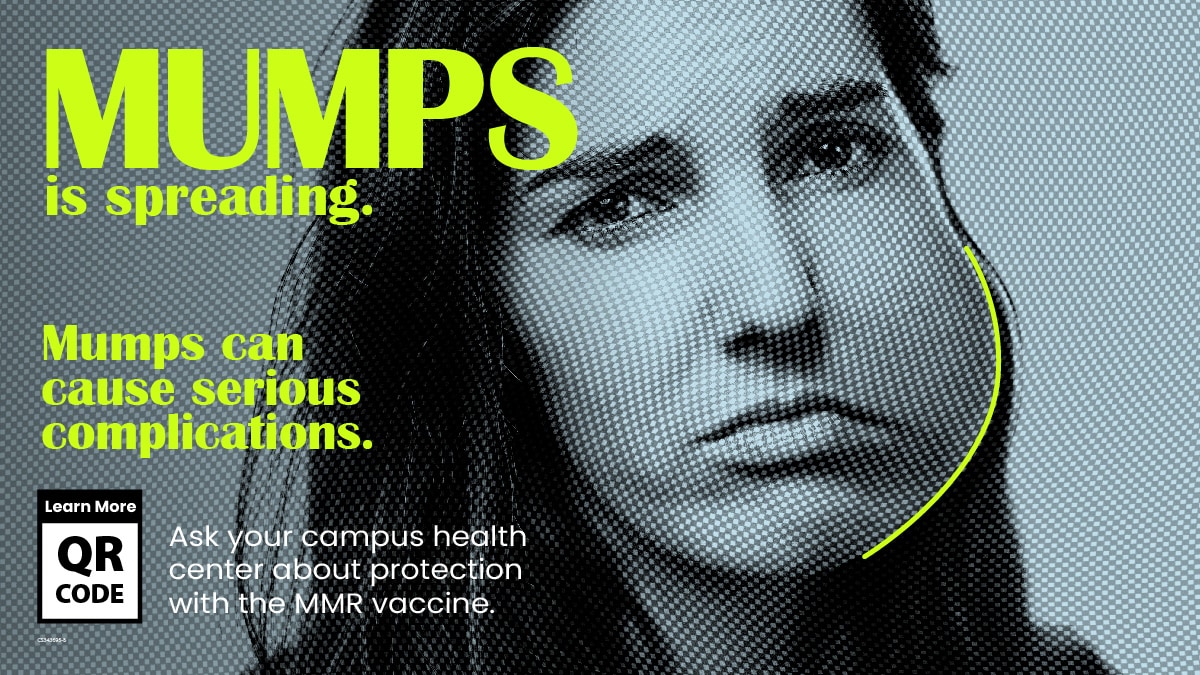 Mumps is spreading