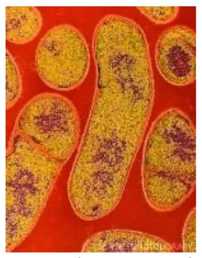 Colored transmission electron micrograph of the Gram-positive anaerobic bacteria Clostridium botulinum.