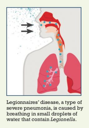 Lung diagram