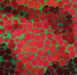 Photo: Virginia Abrams, Lipid Cells, 2009.