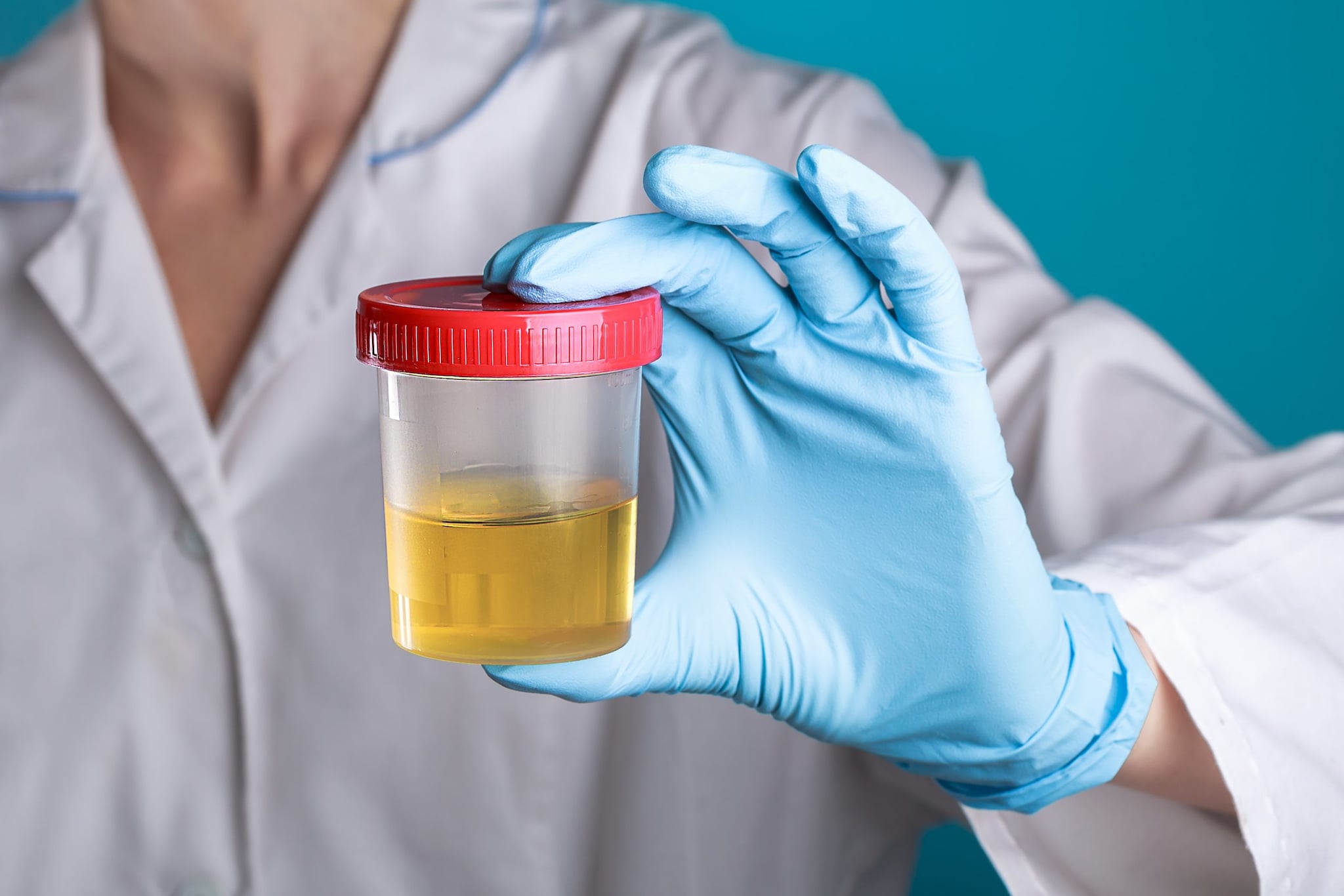 Lab personnel holding a urine specimen.