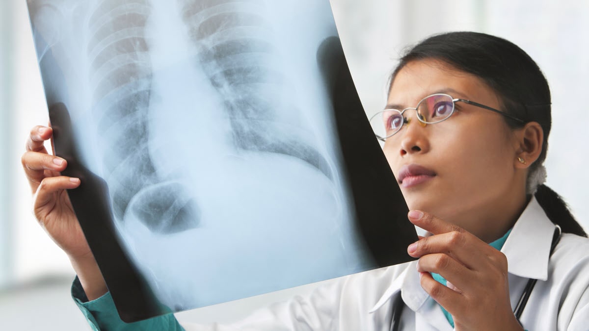 A female health care provider holds a chest x-ray film to the light to examine it.