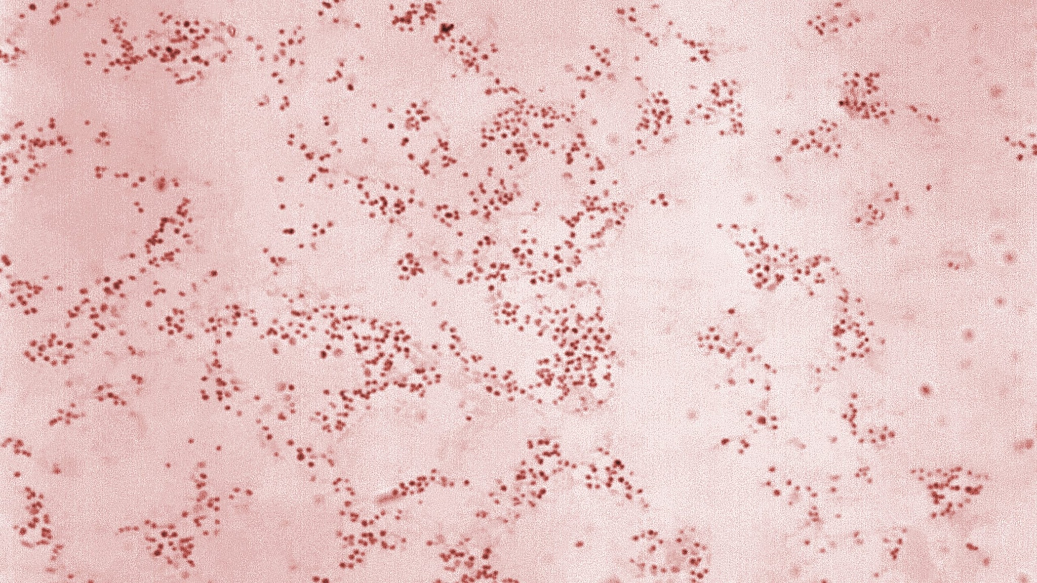 Francisella tularensis bacteria.