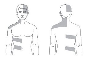 Illustration of shingles.